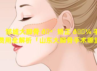 邹城大脚骨 🪴 矫正 🐼 手术费用全解析「山东大脚骨手术哪里做得好」